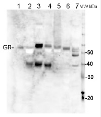 GR | Glutathione reductase in the group Antibodies for Plant/Algal  / Environmental Stress / Oxidative stress at Agrisera AB (Antibodies for research) (AS06 181)
